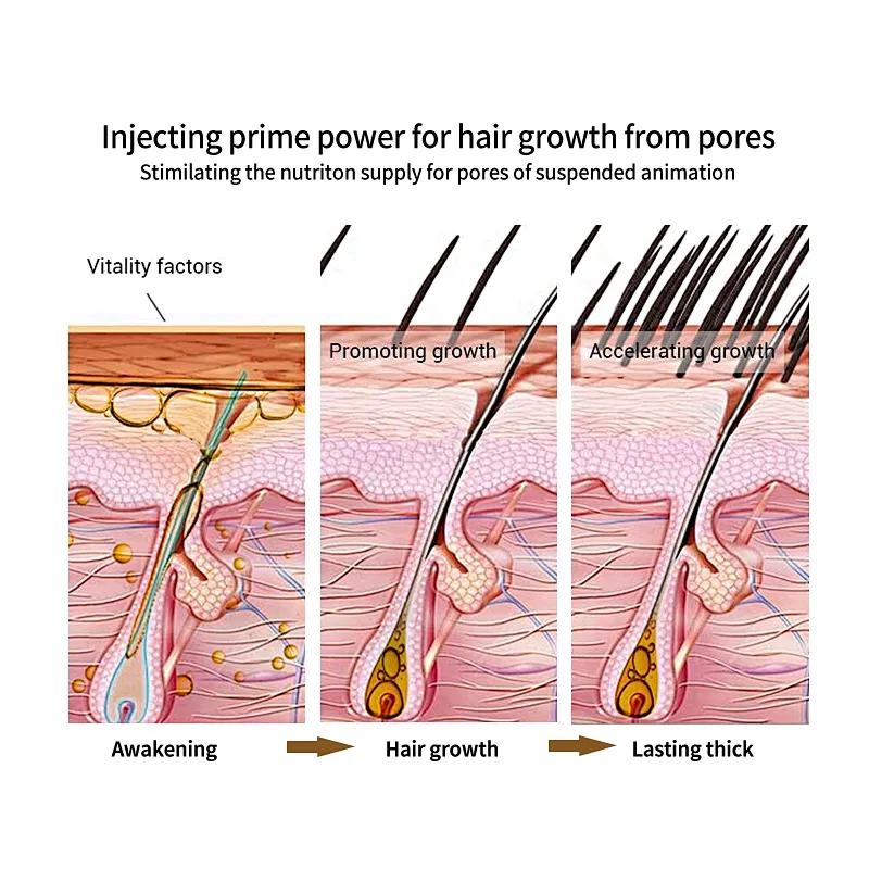 Fast Powerful Hair Growth Essence Anti Hair Loss Products Essential hair Treatment