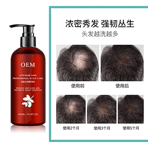 Professional OEM anti hair loss sulfate free shampoo Hair growth shampoo