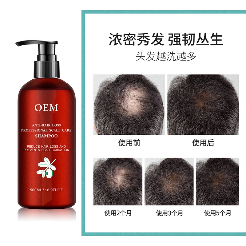 Professional OEM anti hair loss sulfate free shampoo Hair growth shampoo