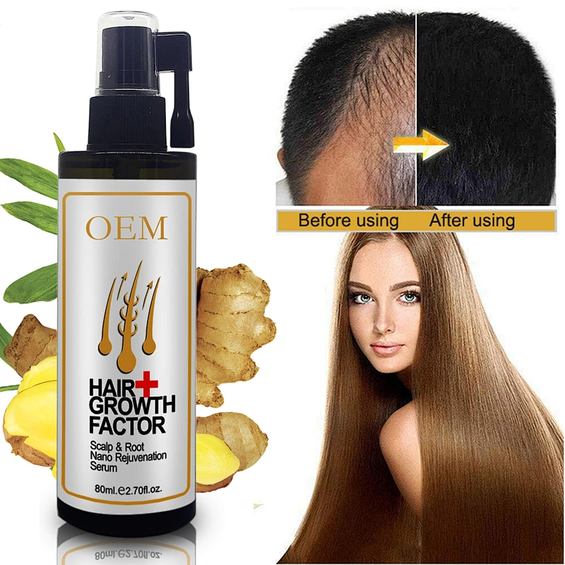 Customized OEM hair growth serum Hair Protection HAIR Growth OIL for men and women