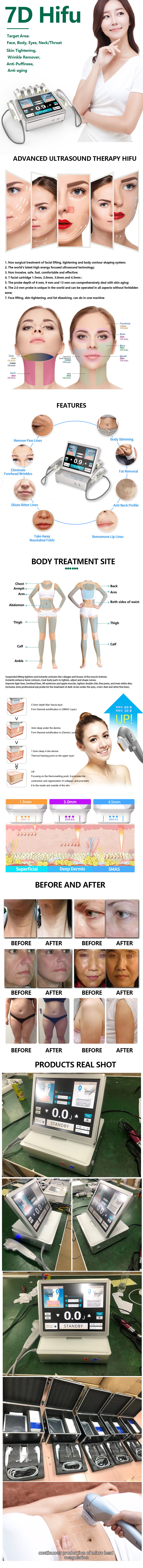 2022 new 3d 4d 5d hifu 7d 9d smas vaginal tighten facial ice mini cartridge facelift ultrasonic weight loss slimming machine gel