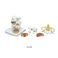 Big Lumbar set Disease Discs