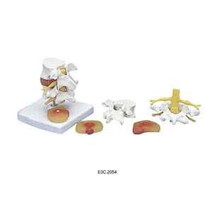 Big Lumbar set Disease Discs