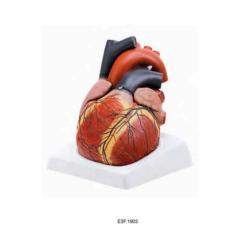 Enlarged Heart 4 parts
