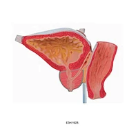 Prostate Model