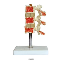 Cutaway osteoporose
