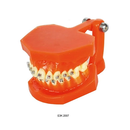 Metal bracket orthodonics model