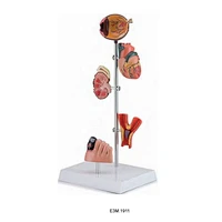 Diabetesmodell, 5 deler