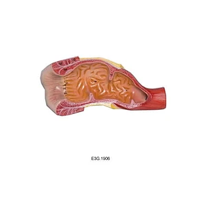 Rectum et canal anal