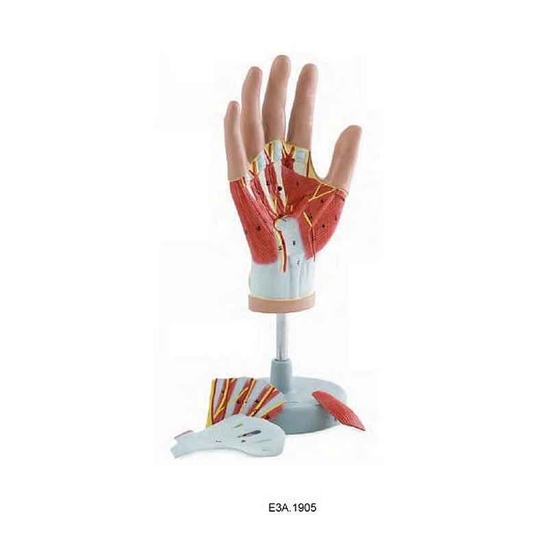 손의 Reginoal 해부학, 4parts