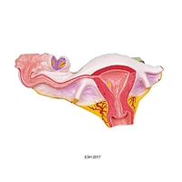Natural Uterus