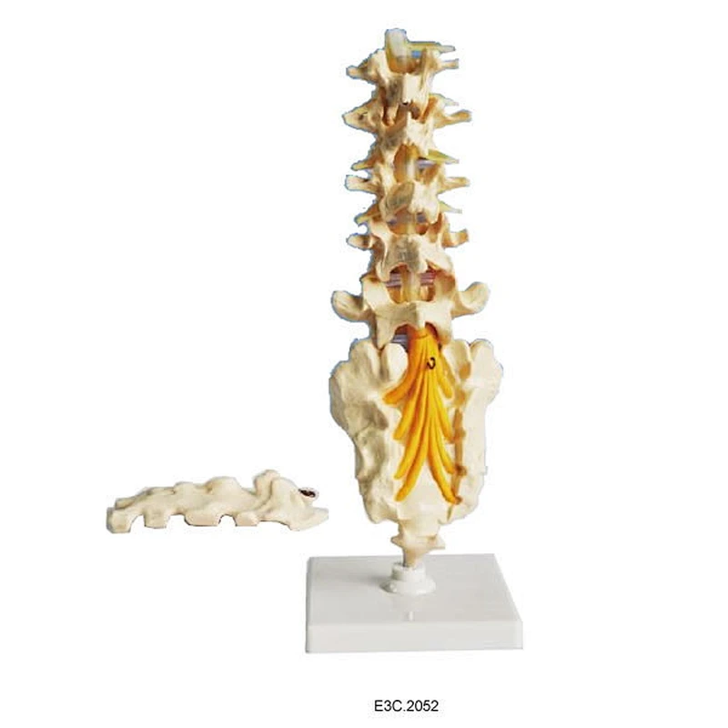Lumbar spinal column