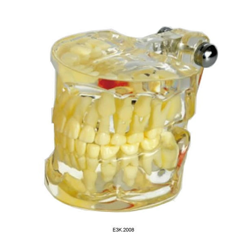 Clear Mixed Pentition