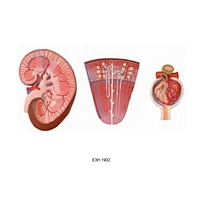 Enlarged Glumerulus,Nephron,Kidney