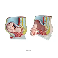Human Pregnant Uterus