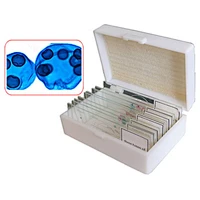 Máng trượt nước, Cuộc sống nước ngọt, Bộ 15