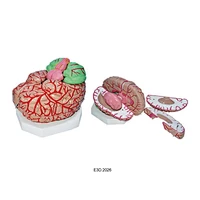 Enlarged Brain with Arteries Model