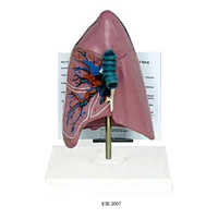 Anat-khí quản/phổi Model Widescription Plate