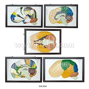 Relief Model of Human Brain
