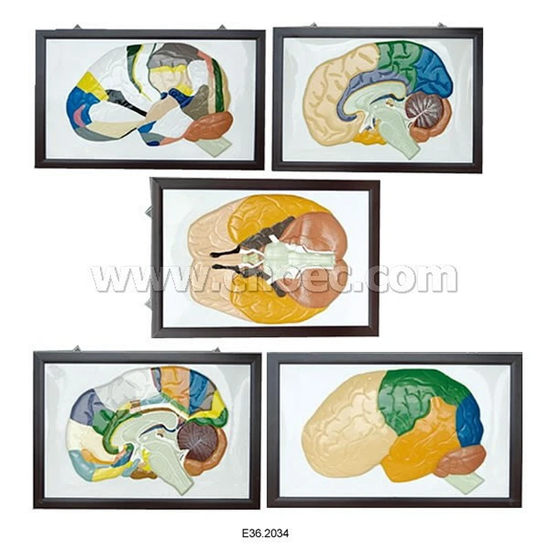 Relief Model of Human Brain