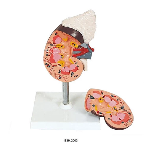Human Kidney with Adrenal Gland
