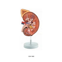 Deluxe Model of Kidney With Adrenal,1part