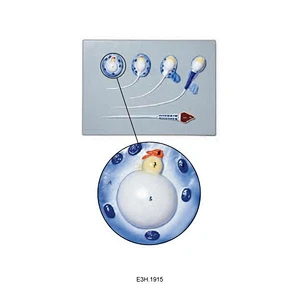 Spermiogenese