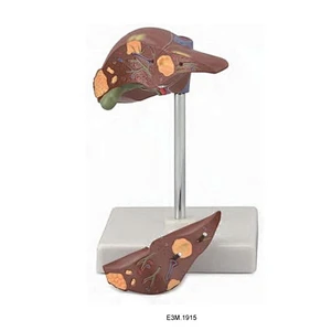 Syg levermodel