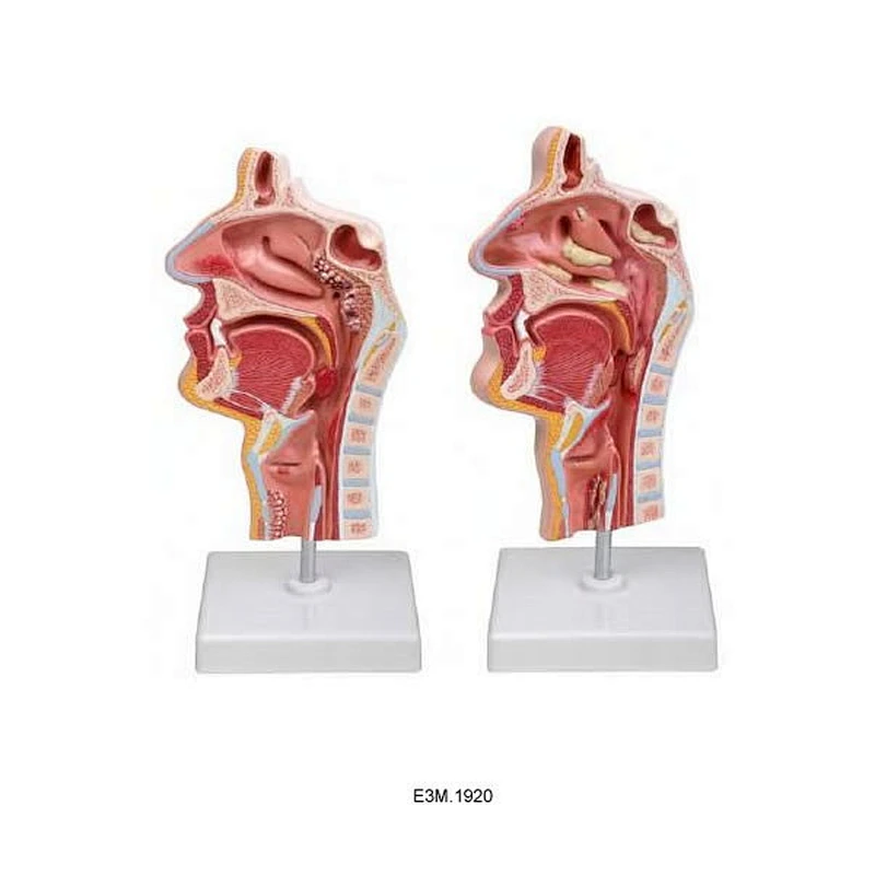 Modèle de nez et de larynx de la maladie (maladie de 2 types)