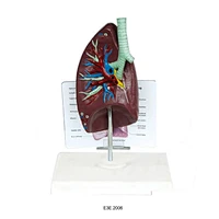 Anat-khí quản/phổi Model Widescription Plate