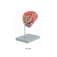 Male Urinary Bladder with Prostate - 2 Parts