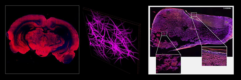 Fluorescence Confocal Microscope