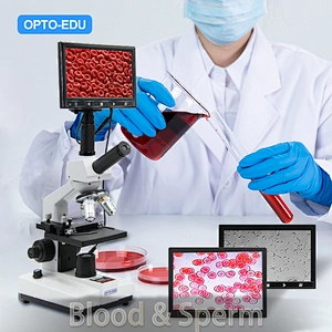 How to Select a Suitable Microscope for Blood & Sperm Observation（Bright Field / Dark Field / Phase Contrast / Heating Stage / Digital Camera）