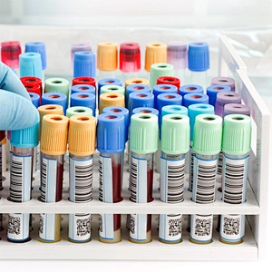 TEST TUBE LABEL