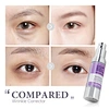 under eye cream
eye wrinkle cream
eye cream for dark circles and puffiness