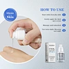 Face Remove Melasma Freckle