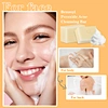 acne soap bar
acne removal soap
Anti Acne Removing soap for face acne