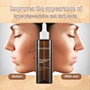 Discoloration Correcting Serum
dark spot corrector remover for dark skin
Hyperpigmentation Dark Spot Corrector Glow Serum