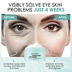 eye repair cream
hydration eye cream
skin care eye cream