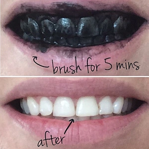 Natural Activated Carbon Tooth Whitening Charcoal Tooth Powder Clean whitening to smoke yellow can be customized