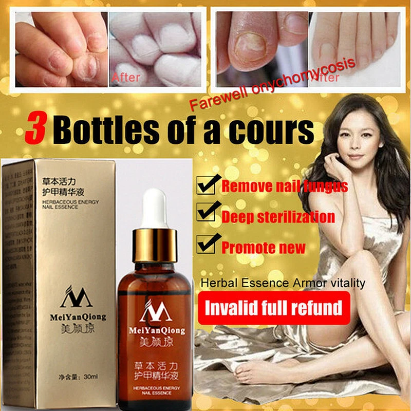 Toe Nail Fungus Removal Gel Anti Infection Paronychia Onychomycosis Fungal Nail Treatment Essence