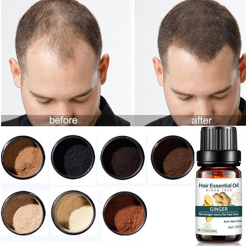 Amazon Hotselling OEM 10ml Ginger Hair Growth Esseential Oil
