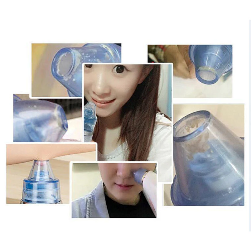 Factory wholesale 800mah facial cleaner pore cleanser for remove blackheads