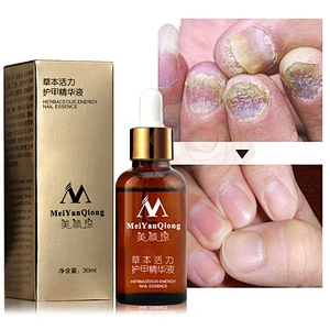 Toe Nail Fungus Removal Gel Anti Infection Paronychia Onychomycosis Fungal Nail Treatment Essence