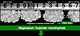magnesium sulphate heptahydrate