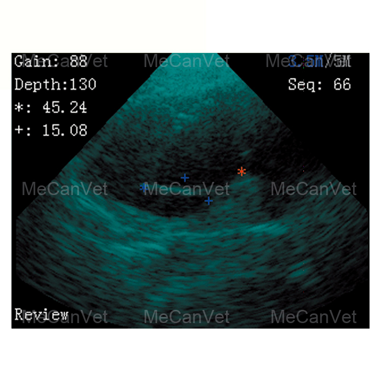 ultrasound probe wireless clear image-2