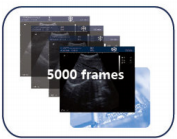 Ultrasound Machine store up to 5000 image frames