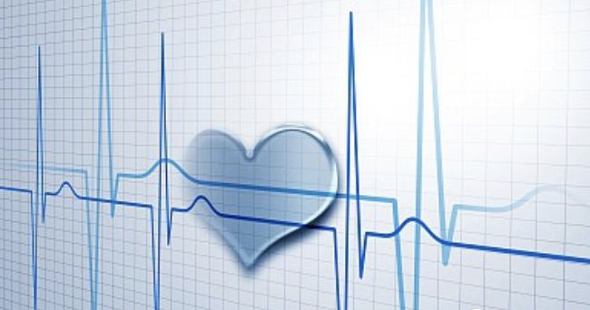 ecg monitor,ecg monitoring,pet monitor