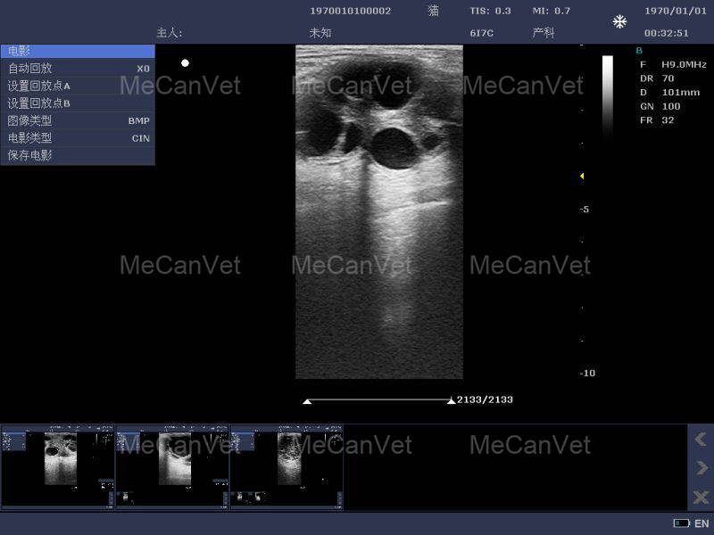 Imaging Of Ultrasonic Diagnostic Scanner3