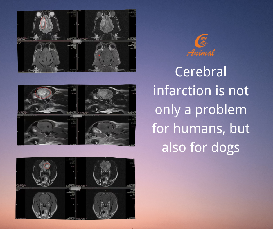Cerebral infarction x ray imagings
